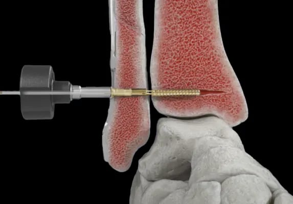 medical-grade Animation