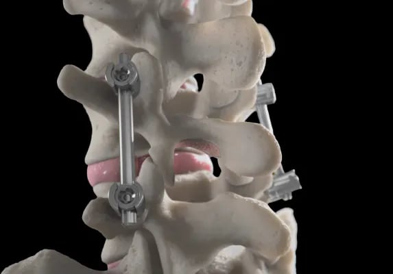 medical-grade Animation