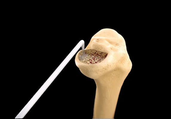 medical-grade Animation