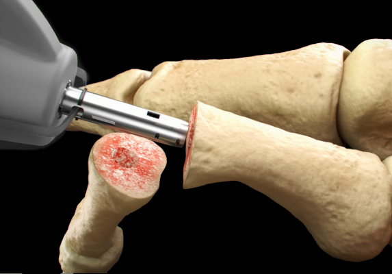 medical-grade Animation